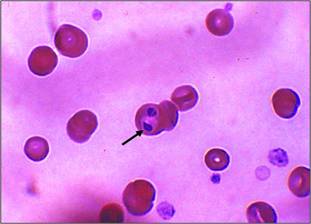 Babesia canis u eritrocitima