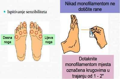 Ispitivanje senzibiliteta stopala